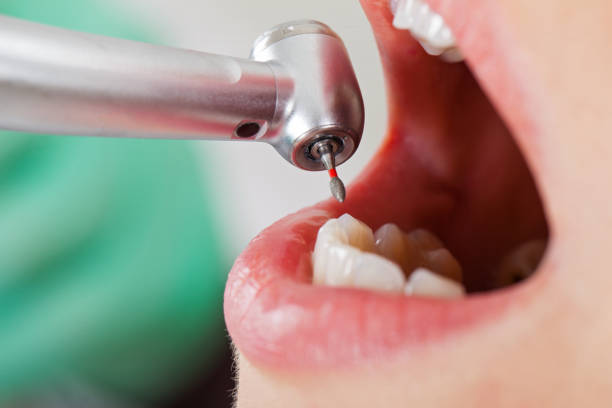 Best Pediatric Emergency Dentist in Pell City, AL